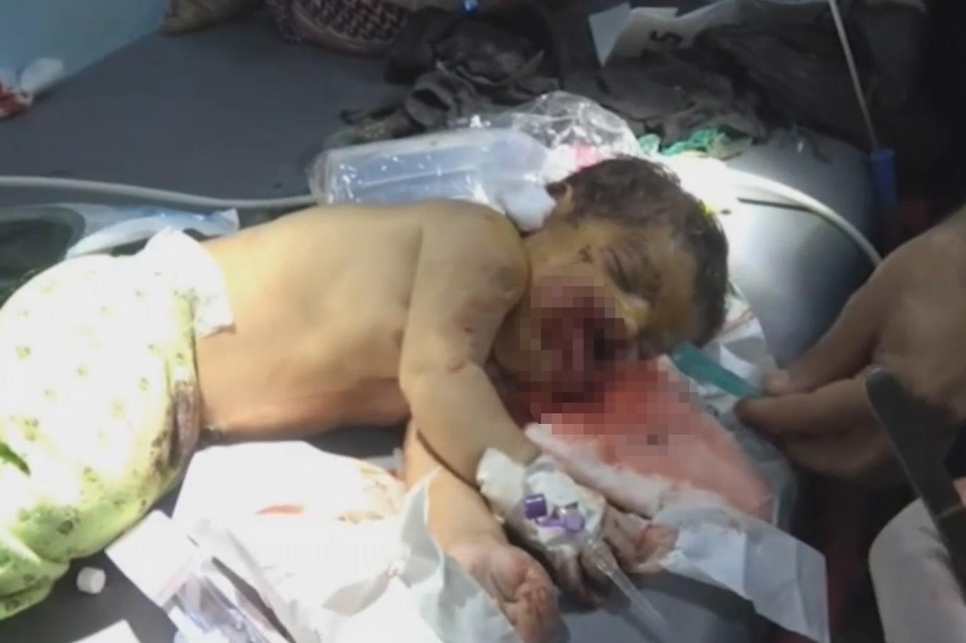 Suudi koalisyonu Yemen'de düğün yerine saldırdı: Onlarca ölü ve yaralı
